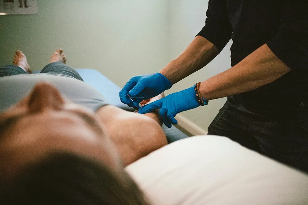 Dry Needling 2 (1)_result